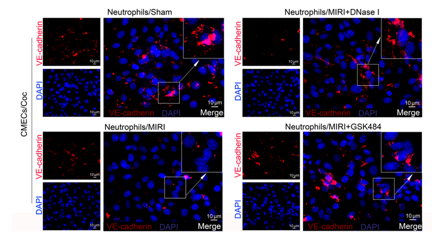 MCE DNase I, from Bovine Pancreas