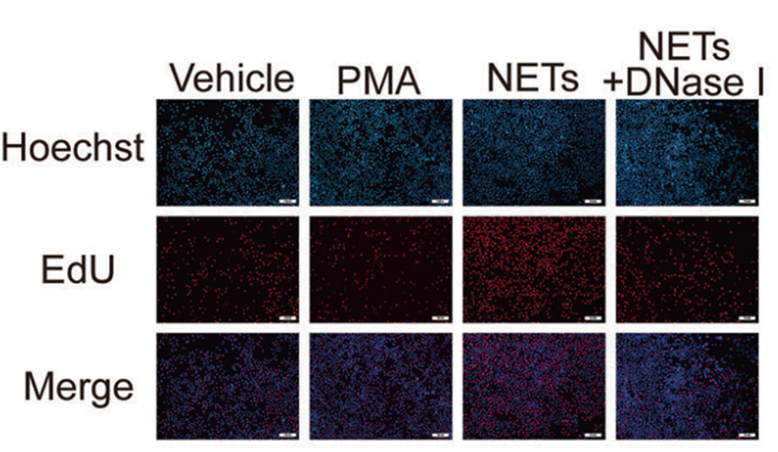 MCE DNase I, from Bovine Pancreas