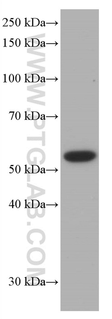 Proteintech™ p53 Monoclonal Antibody (6C4B6), 150 µL 