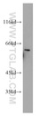 Proteintech™ ETV4 Polyclonal Antibody, 150 µL