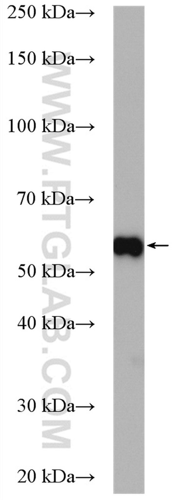 Proteintech™ ETV4 Polyclonal Antibody, 150 µL