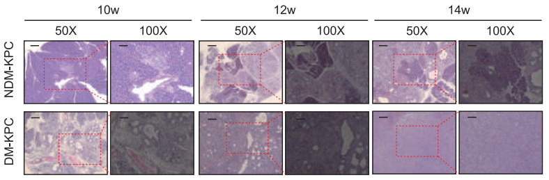 MCE Streptozotocin (STZ) ≥99.20%