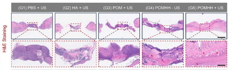 MCE Streptozotocin (STZ) ≥99.20%