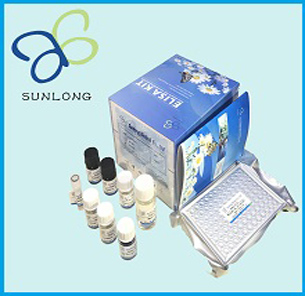 Human salmonella typhi antibody IgM (ST-IgM) ELISA Kit