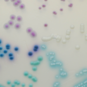 CHROMagar™ Candida Plus