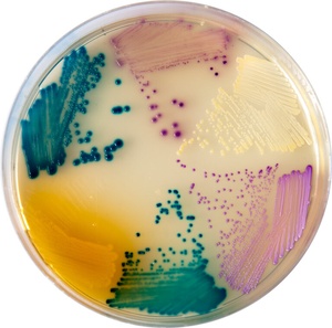 CHROMagar™ Orientation (UTI chromogenic media) (copy)