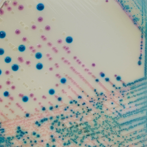 CHROMagar™ KPC Supplement