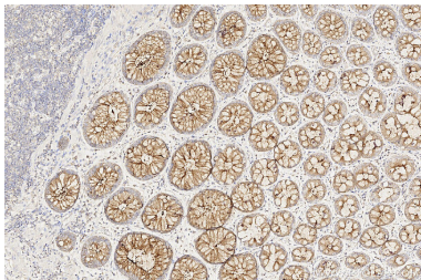 Proteintech™ MUC1/CA15-3 Monoclonal Antibody (1D5D11), 150 µL 