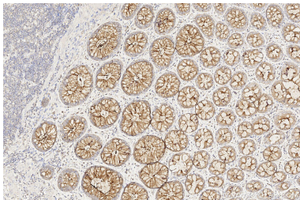 Proteintech™ MUC1/CA15-3 Monoclonal Antibody (1D5D11), 150 µL