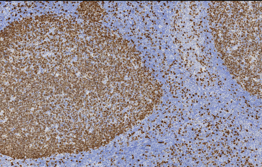 Proteintech™ Ki-67 Monoclonal Antibody (1B9H2), 150 µL 