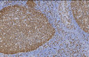Proteintech™ Ki-67 Monoclonal Antibody (1B9H2), 150 µL