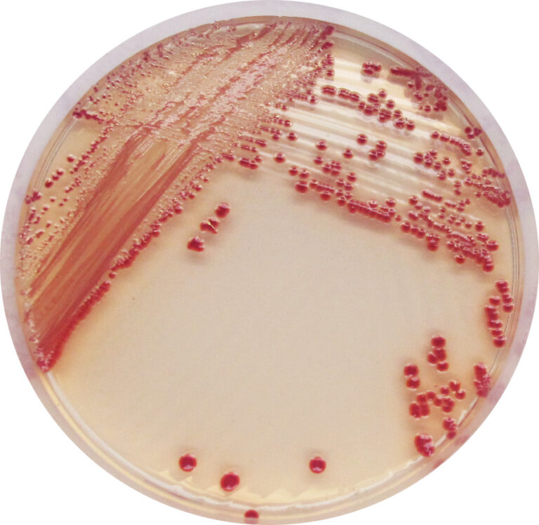 CHROMagar™ Acinetobacter Kit