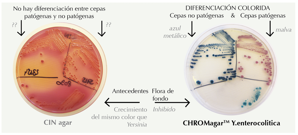 CHROMagar™ Y. enterocolitica Kit, 5000 mL Pack (Base Medium + Supplement)