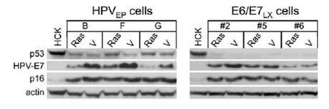 Thermo Scientific™ Invitrogen™ HPV Type 16 E7 Monoclonal Antibody (8C9), 50 µg