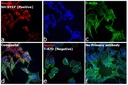 Invitrogen™ Goat anti-Mouse IgG (H+L) Highly Cross-Adsorbed Secondary Antibody, Alexa Fluor™ Plus 594, 1mg