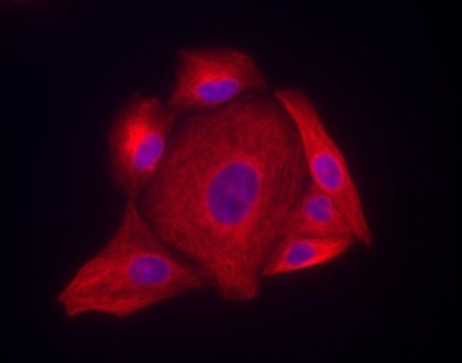 Invitrogen™ Goat anti-Mouse IgG (H+L) Highly Cross-Adsorbed Secondary Antibody, Alexa Fluor™ Plus 594, 1mg
