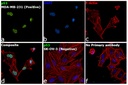 Invitrogen™ p53 Monoclonal Antibody (DO-7), 500 µL