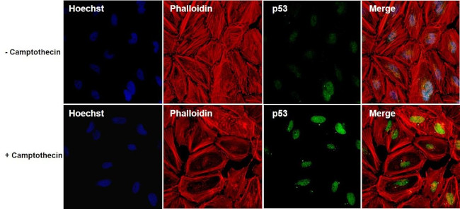Invitrogen™ p53 Monoclonal Antibody (DO-7), 500 µL