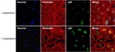 Invitrogen™ p53 Monoclonal Antibody (DO-7), 500 µL