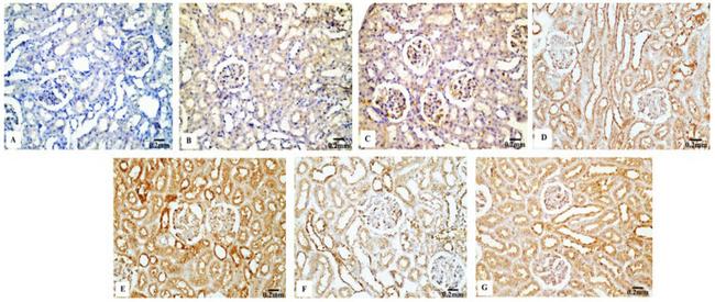 Invitrogen™ p53 Monoclonal Antibody (DO-7), 500 µL
