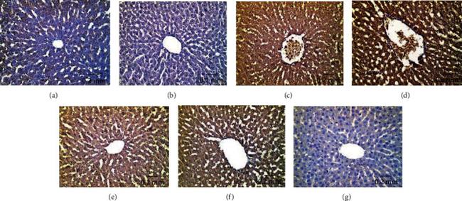 Invitrogen™ p53 Monoclonal Antibody (DO-7), 500 µL