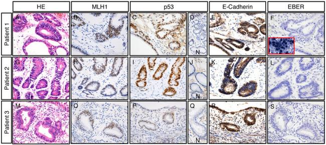 Invitrogen™ p53 Monoclonal Antibody (DO-7), 500 µL