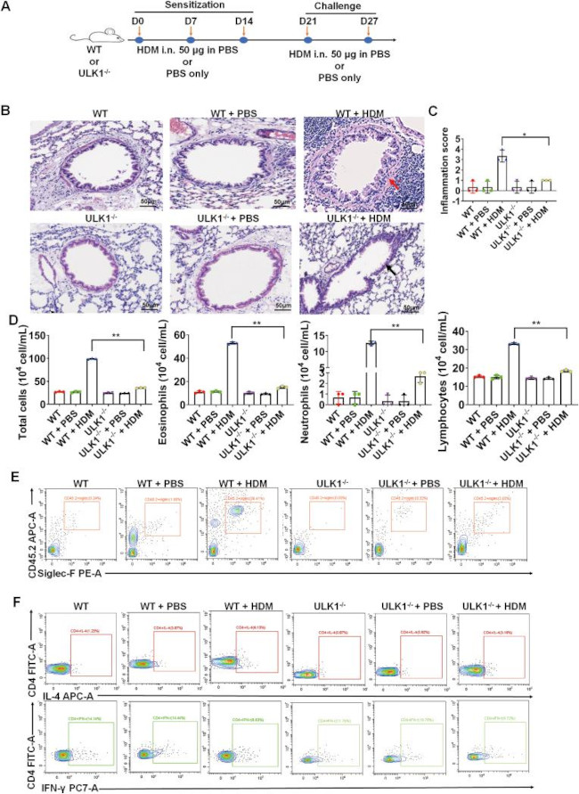 Invitrogen™ IL-4 Monoclonal Antibody (11B11), PE, eBioscience™