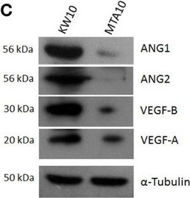 Invitrogen™ Rabbit anti-Mouse IgG (H+L) Secondary Antibody, HRP, 1mL