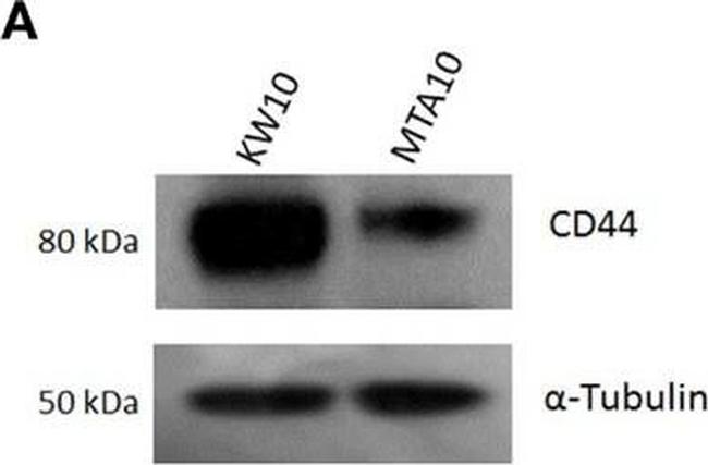 Invitrogen™ Rabbit anti-Mouse IgG (H+L) Secondary Antibody, HRP, 1mL