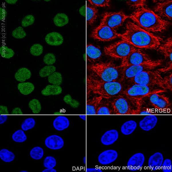 Abcam Mismatch Repair (MSH6, PMS2, MLH1, MSH2) Antibody Panel - Human