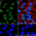 Abcam Mismatch Repair (MSH6, PMS2, MLH1, MSH2) Antibody Panel - Human