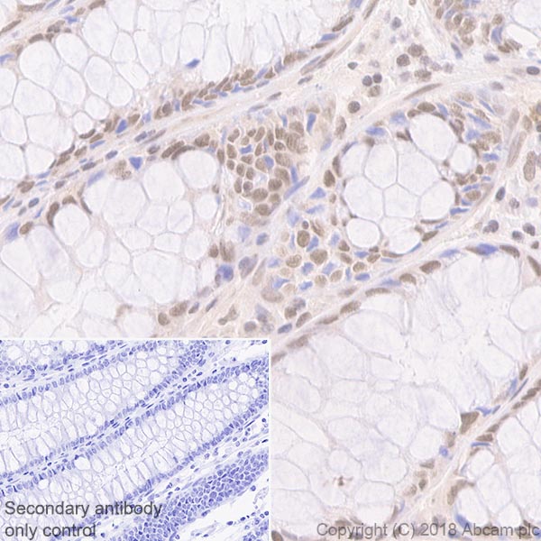 Abcam Mismatch Repair (MSH6, PMS2, MLH1, MSH2) Antibody Panel - Human