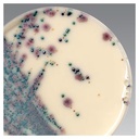 Thermo Scientific™ Brilliance™ Candida Selective Supplement, 10 x 10 mL