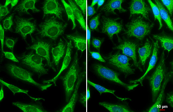 Invitrogen™ Caspase 3 Polyclonal Antibody, Rabbit IgG, 100 µL