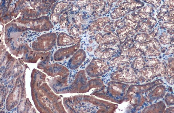 Invitrogen™ Caspase 3 Polyclonal Antibody, Rabbit IgG, 100 µL