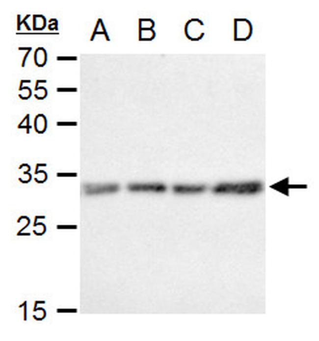 Invitrogen™ Caspase 3 Polyclonal Antibody, Rabbit IgG, 100 µL