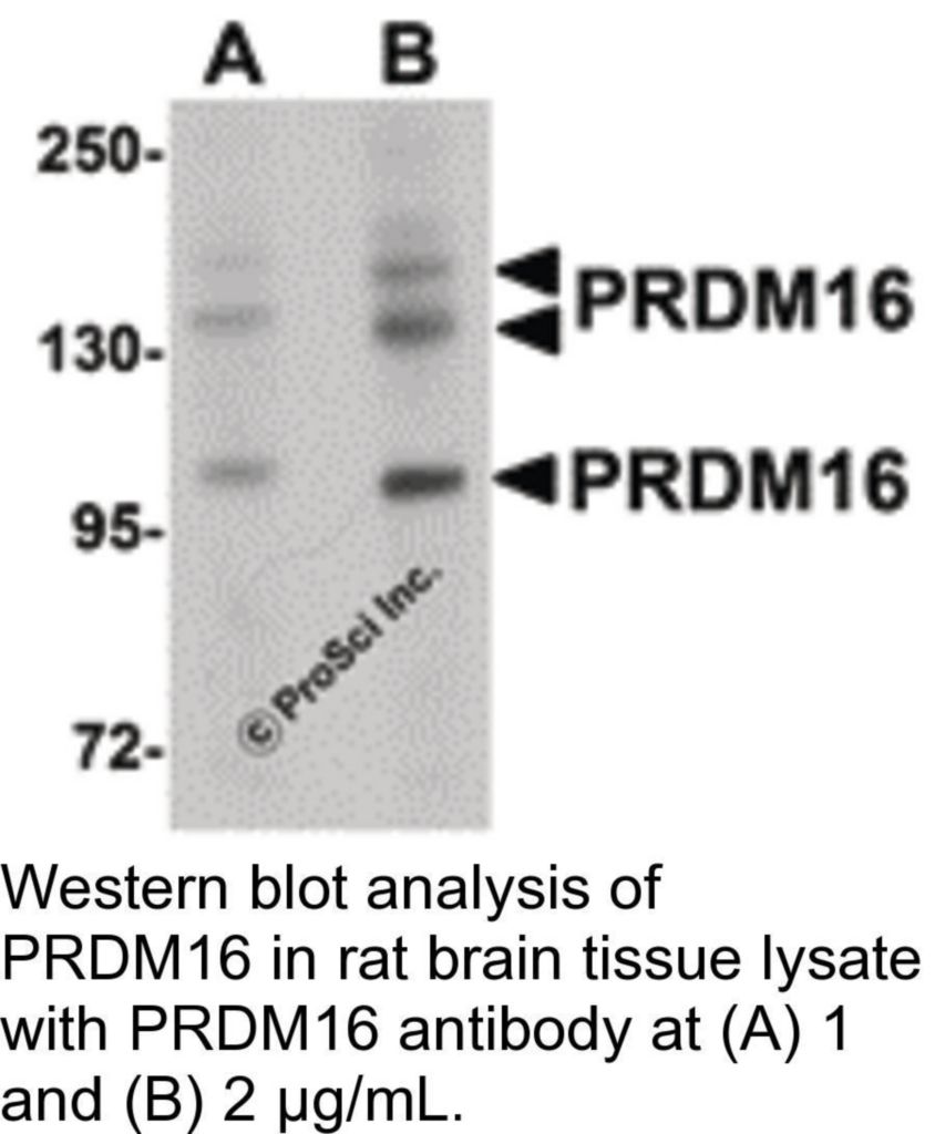 ProSci Anti-PRDM16 Rabbit Polyclonal Antibody, IgG, 100 μG