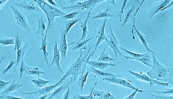 Normal Human Dermal Fibroblasts (NHDF)