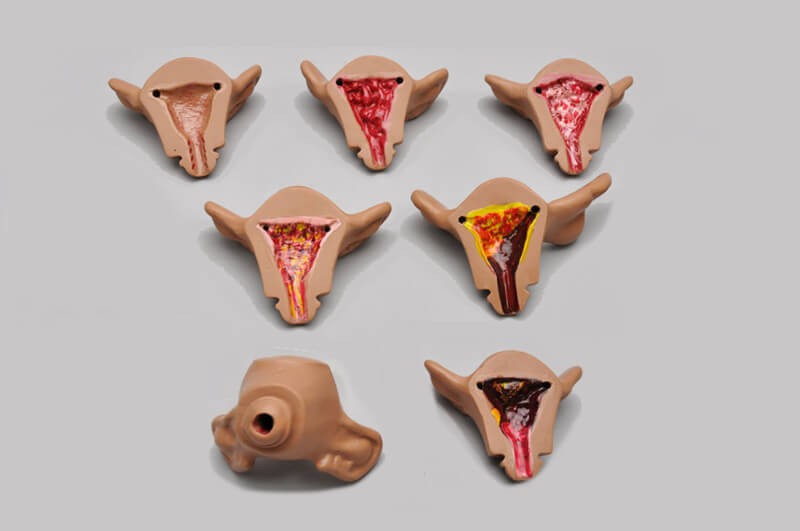 Gaumard Normal and Abnormal Uteri Set for ZOE® S504.100