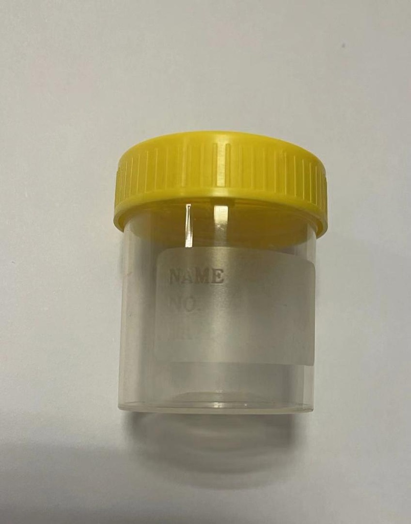 AtuMed Sterile Stool Containers, short, 30mL
