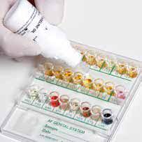 Liofilchem™ A.F. Genital System Reagents for 100 Tests