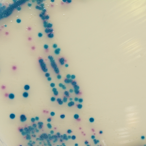 CHROMagar™ supplement for ESBL