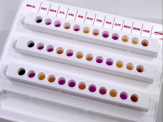 Thermo Scientific™ Oxoid™ Microbact™ Listeria 12L Haemolysin Reagent