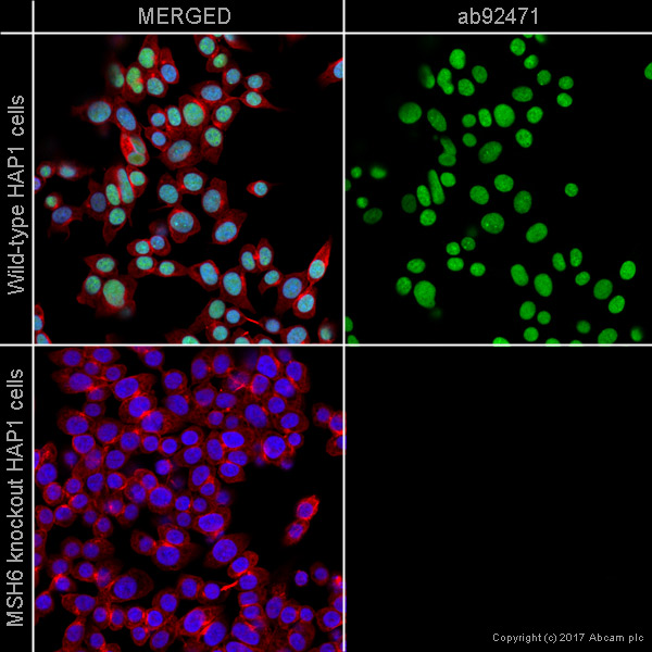 Abcam Mismatch Repair (MSH6, PMS2, MLH1, MSH2) Antibody Panel - Human 