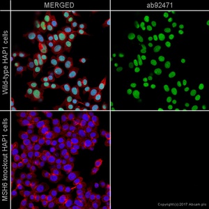 Abcam Mismatch Repair (MSH6, PMS2, MLH1, MSH2) Antibody Panel - Human 