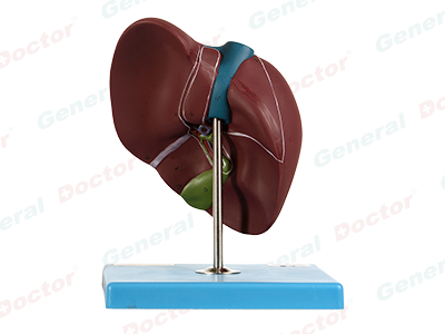 GD Liver Model