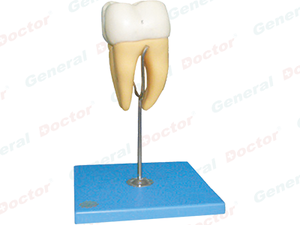 GD Molar Tooth Model 