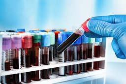 View All Products / Medical Supplies / Cllinical Specimen Collection