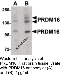 ProSci Anti-PRDM16 Rabbit Polyclonal Antibody, IgG, 100 μG