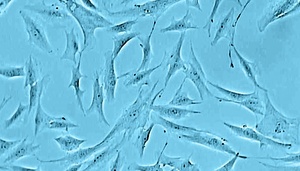 Normal Human Dermal Fibroblasts (NHDF)